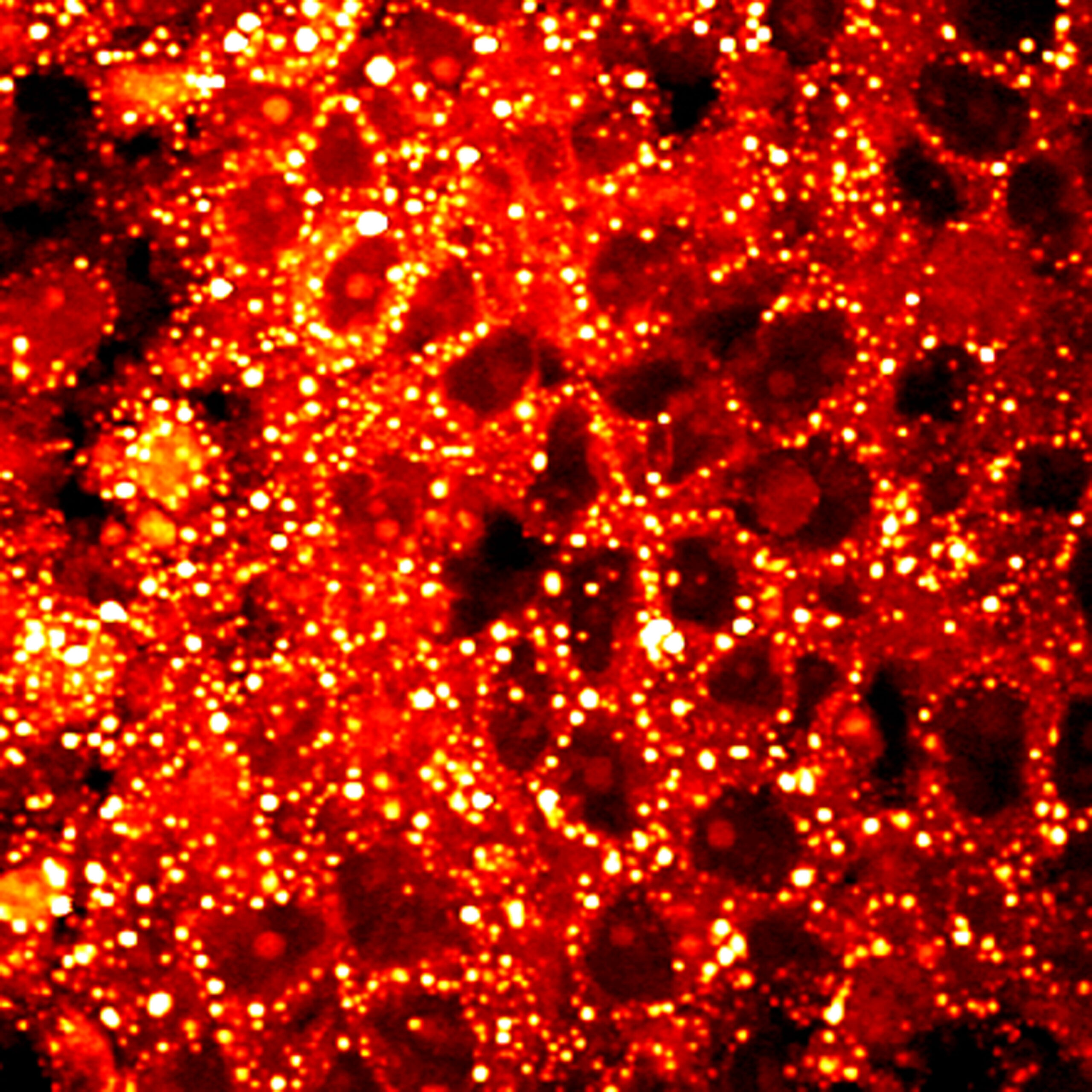 Hormone therapy for prostate cancer may shield from COVID-19