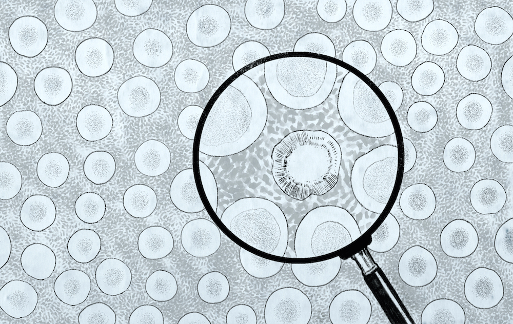 New transatlantic partnership to regain the momentum of cancer research