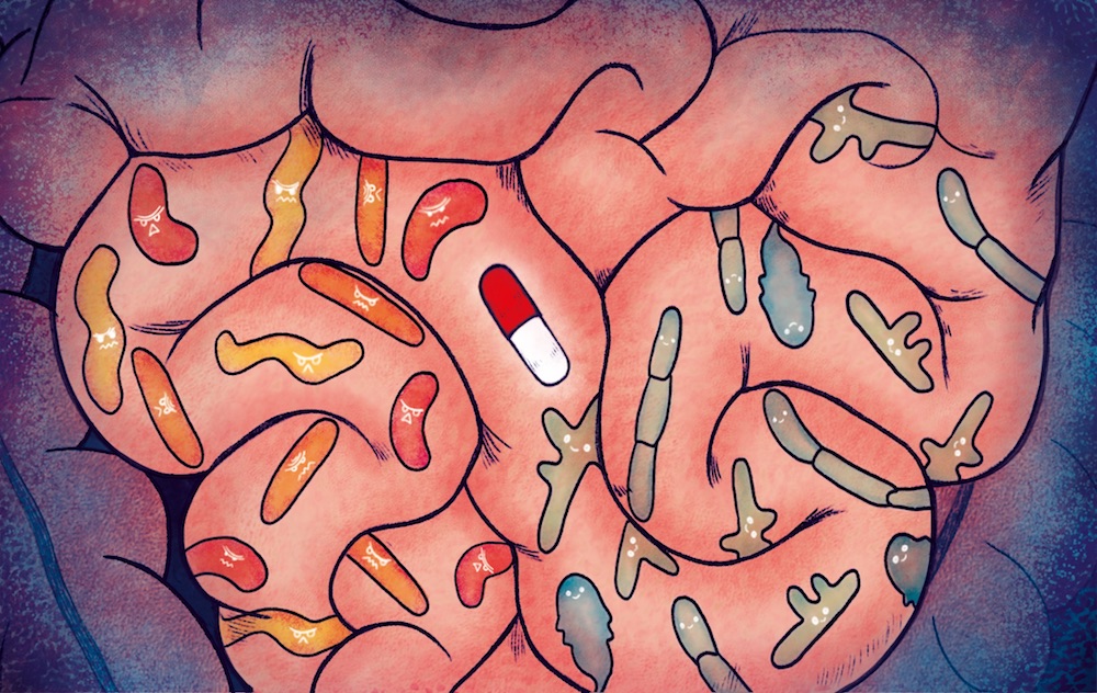 Harmful bacteria play greater role in predicting outcomes of immune checkpoint blockade in melanoma