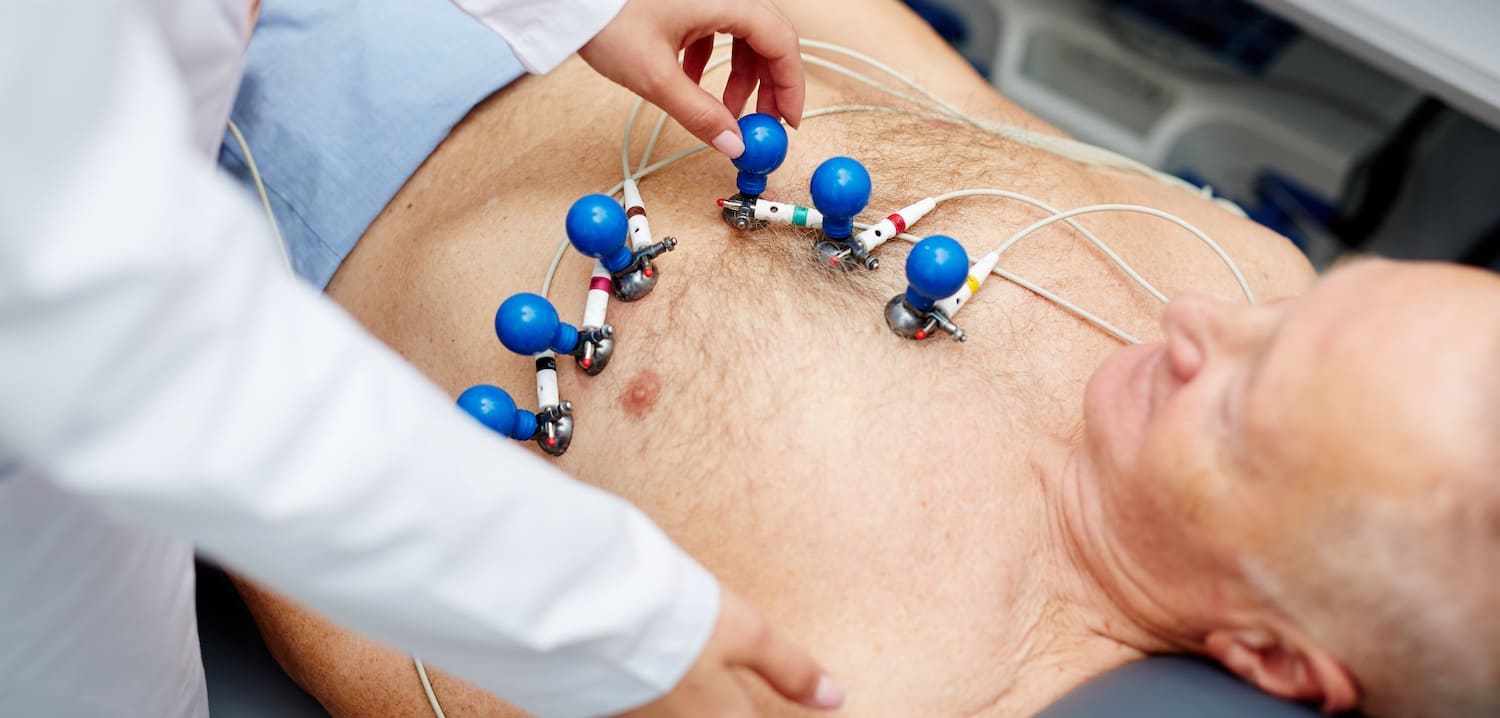 Prolonged ADT use in prostate cancer increases CV mortality: A need for cardiovascular protection