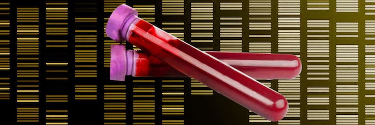 NHS England’s pilot of cancer screening blood test raises questions
