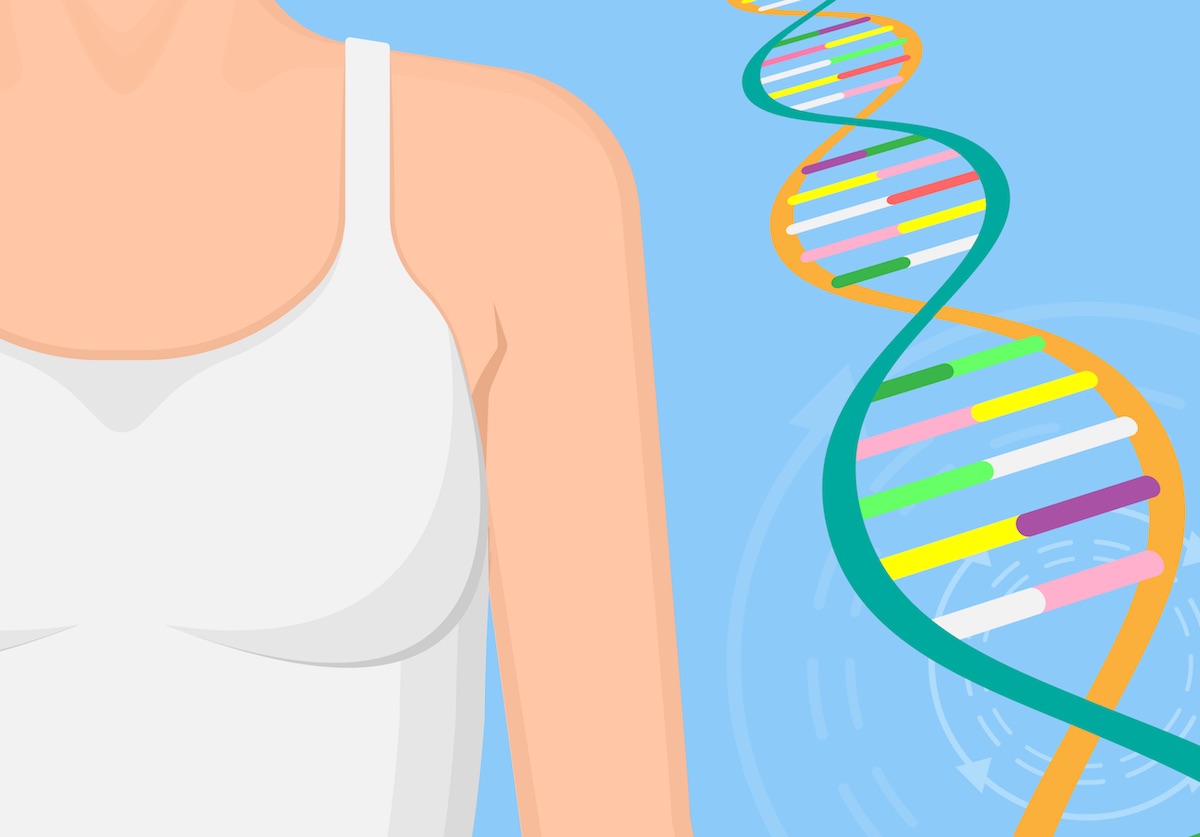 Studies provide clarity on breast cancer genes for genetic panels