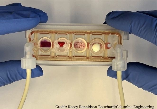 Multi organ chip could facilitate personalised cancer therapy 