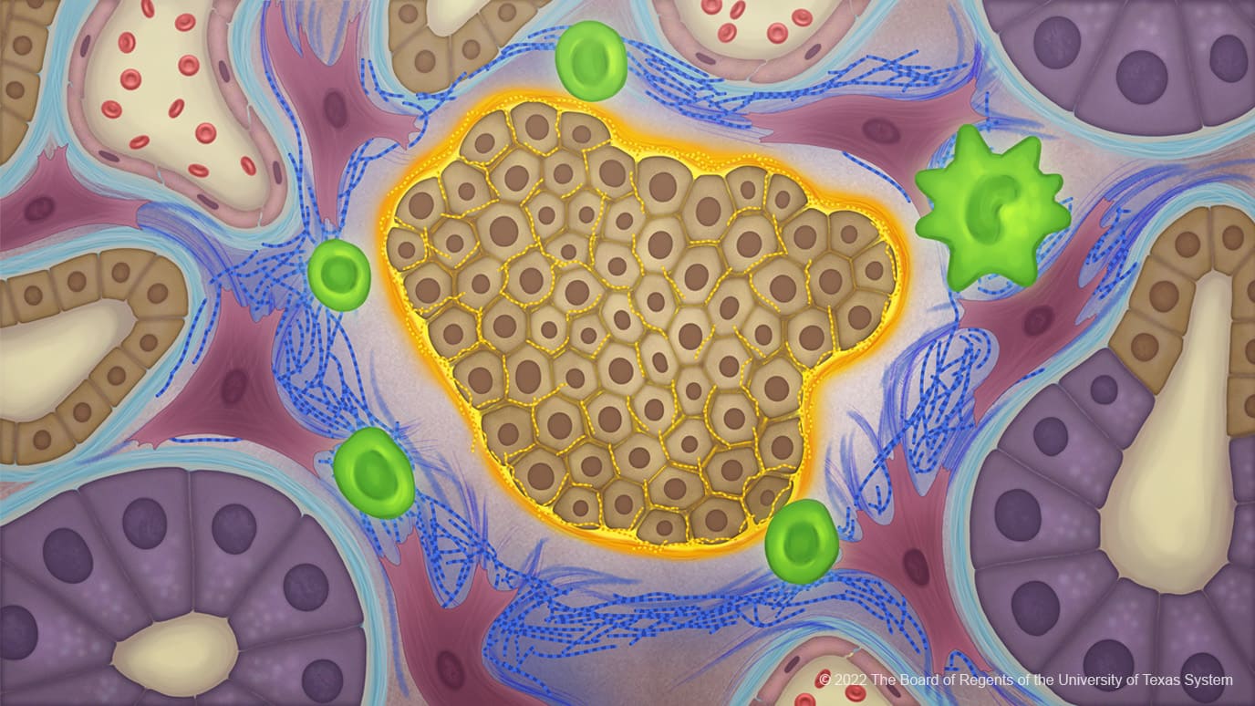 Abnormal collagen provides ‘invisibility cloak’ in pancreatic cancer offering new therapeutic targets