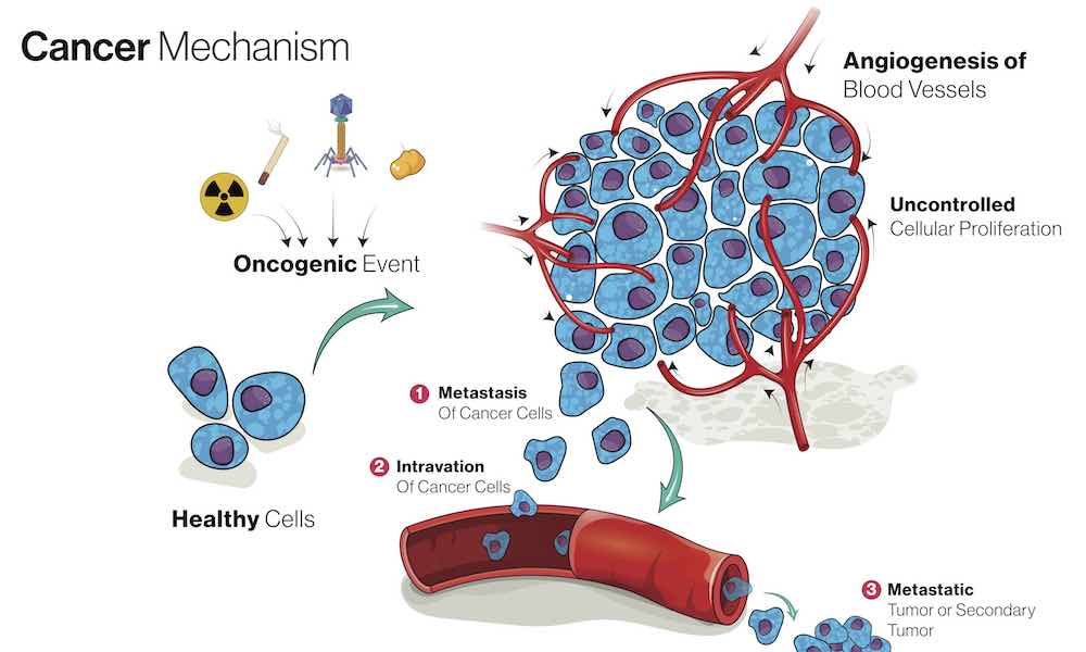 Cancer metastasis hijacks process healthy cells use to move around the body
