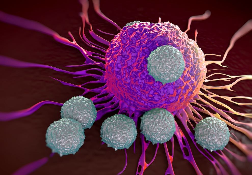 Stopping immunotherapy after two years does not affect NSCLC survival