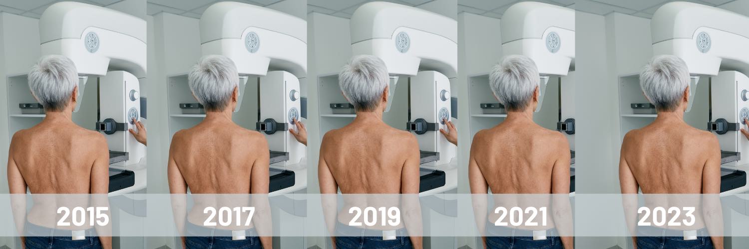 Regular mammography offers best insurance against dying from breast cancer