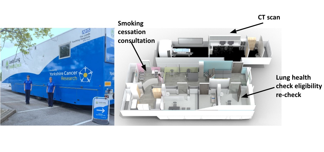 One-stop lung screening and smoking cessation advice works