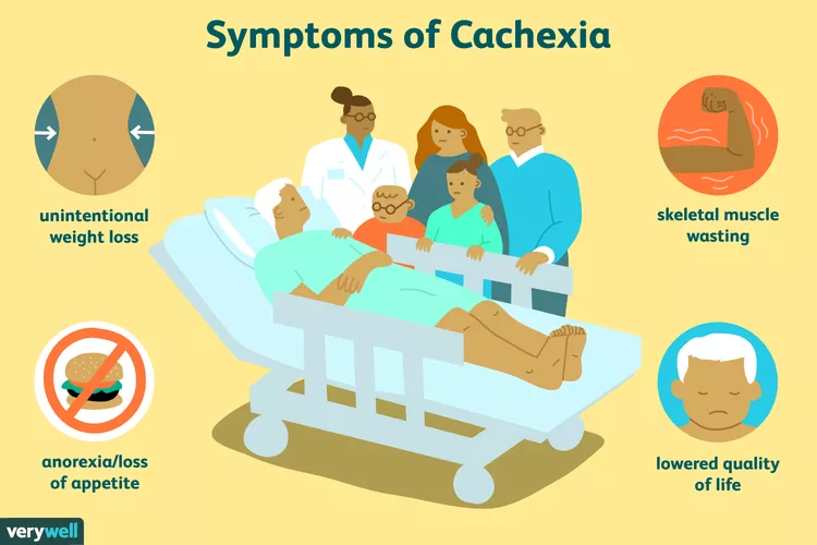 Targeting a circulating cytokine offers new hope in cancer cachexia